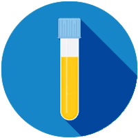 sample preparation for urine for mass spectrometry analysis